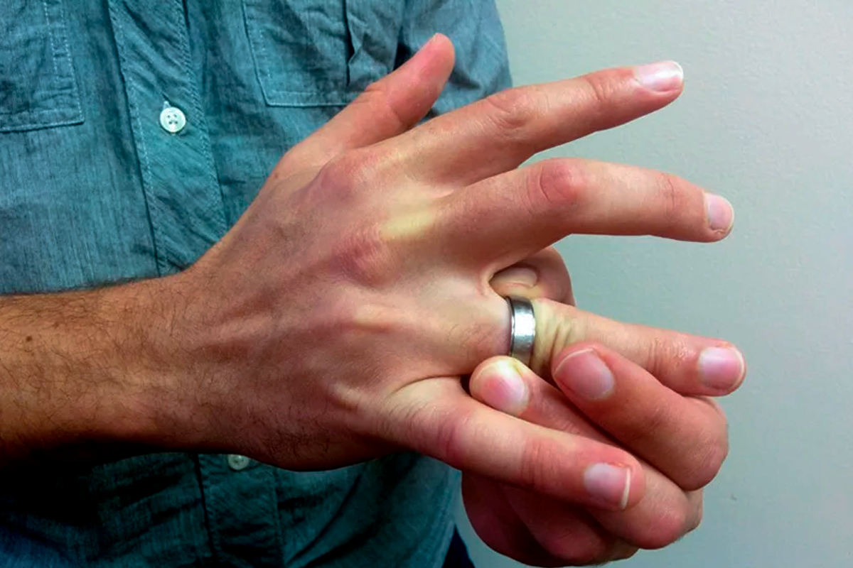 Нападение пальца. Снятое обручальное кольцо. Мужские пальцы.